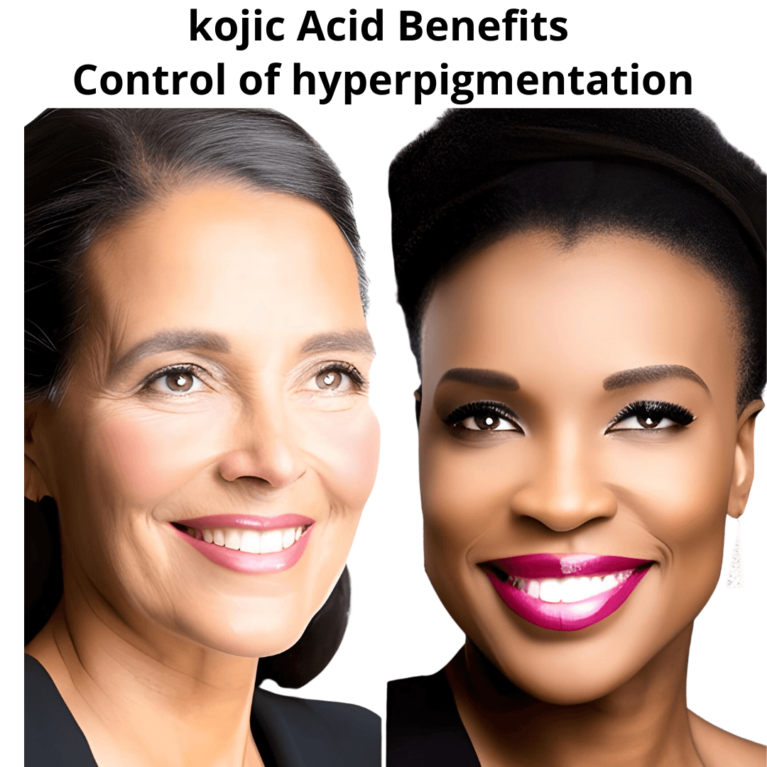Kojic Acid Powder 4 oz - AMOSTIMELINE