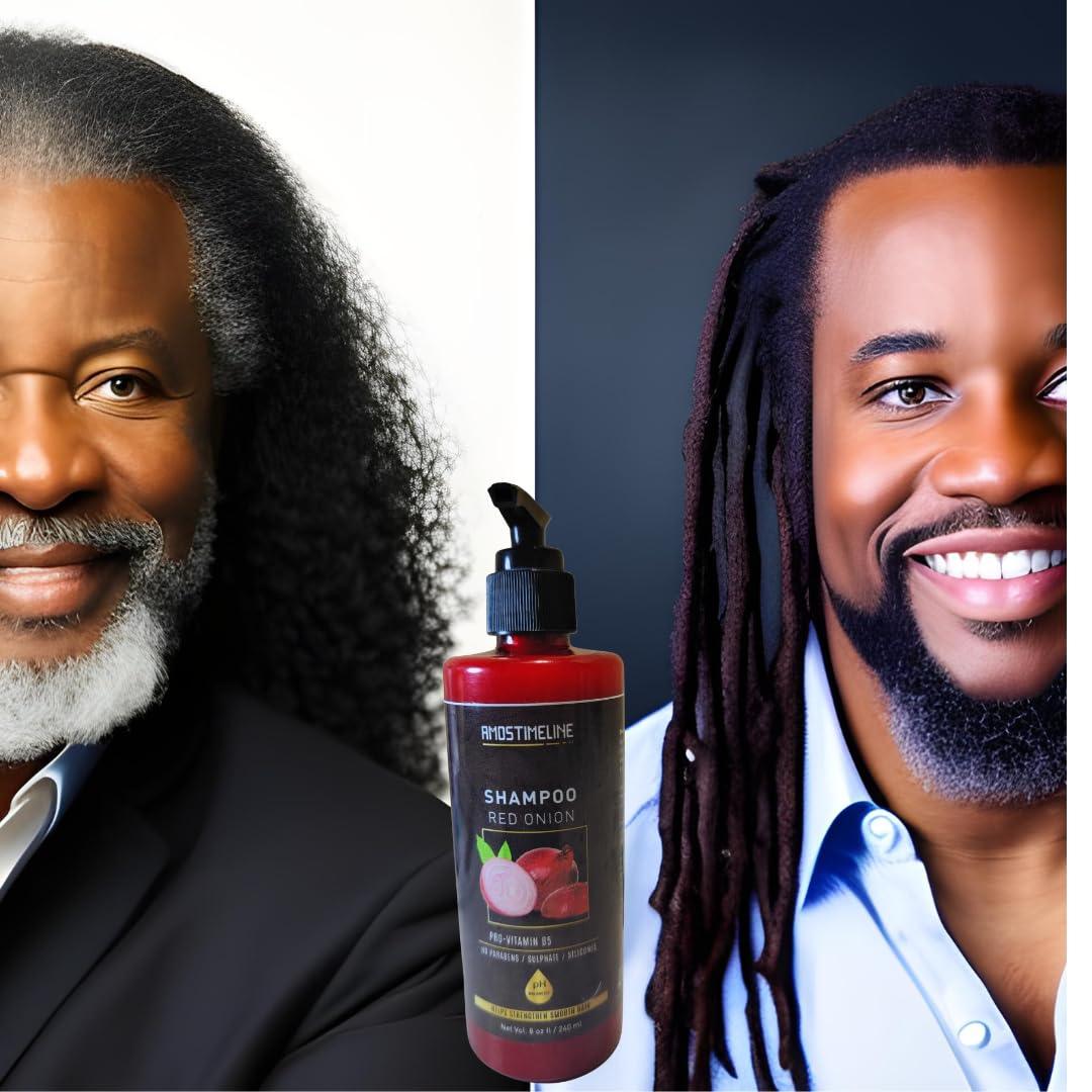 Onion Shampoo 8 fl oz" - AMOSTIMELINE