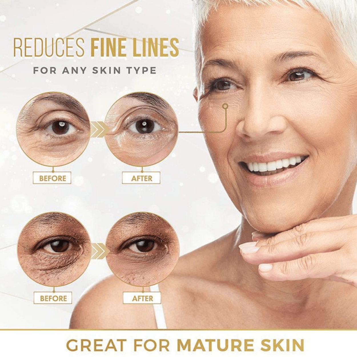 Máscaras de ojos de oro de 24 quilates para ojeras e hinchazón (12 pares) con colágeno, aloe vera y ácido hialurónico, parches antienvejecimiento debajo de los ojos para ojeras e hinchazón, reduce las arrugas. - AMOSTIMELINE