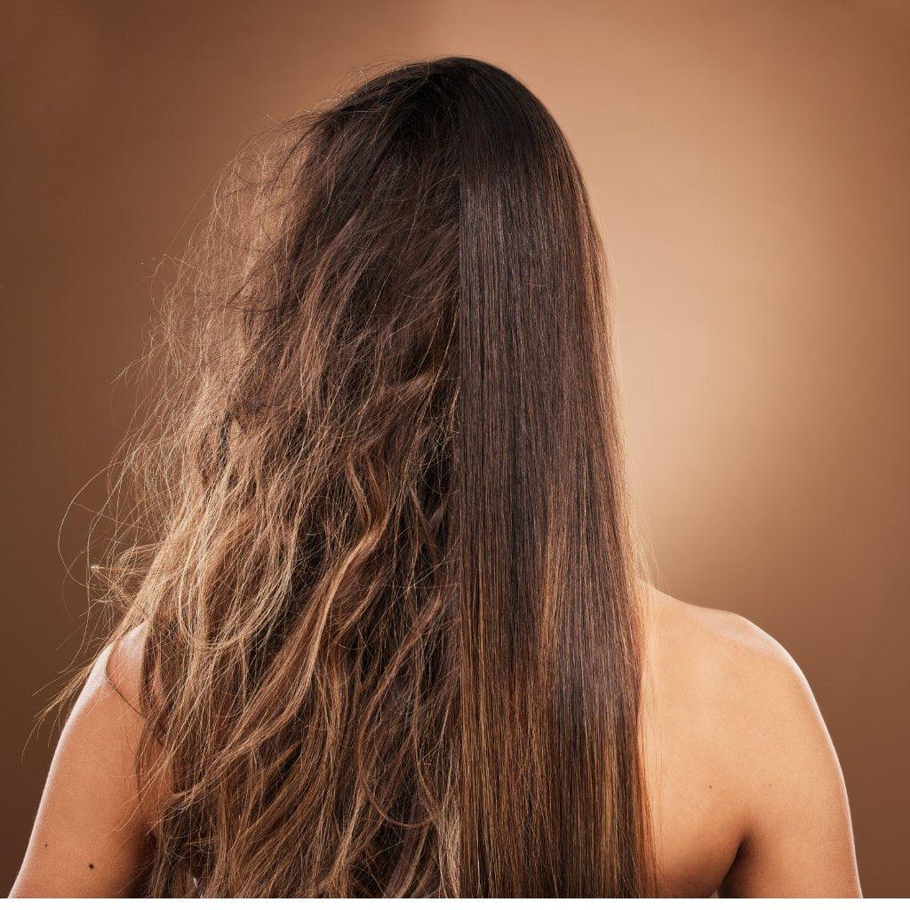 HAIR SURGERY