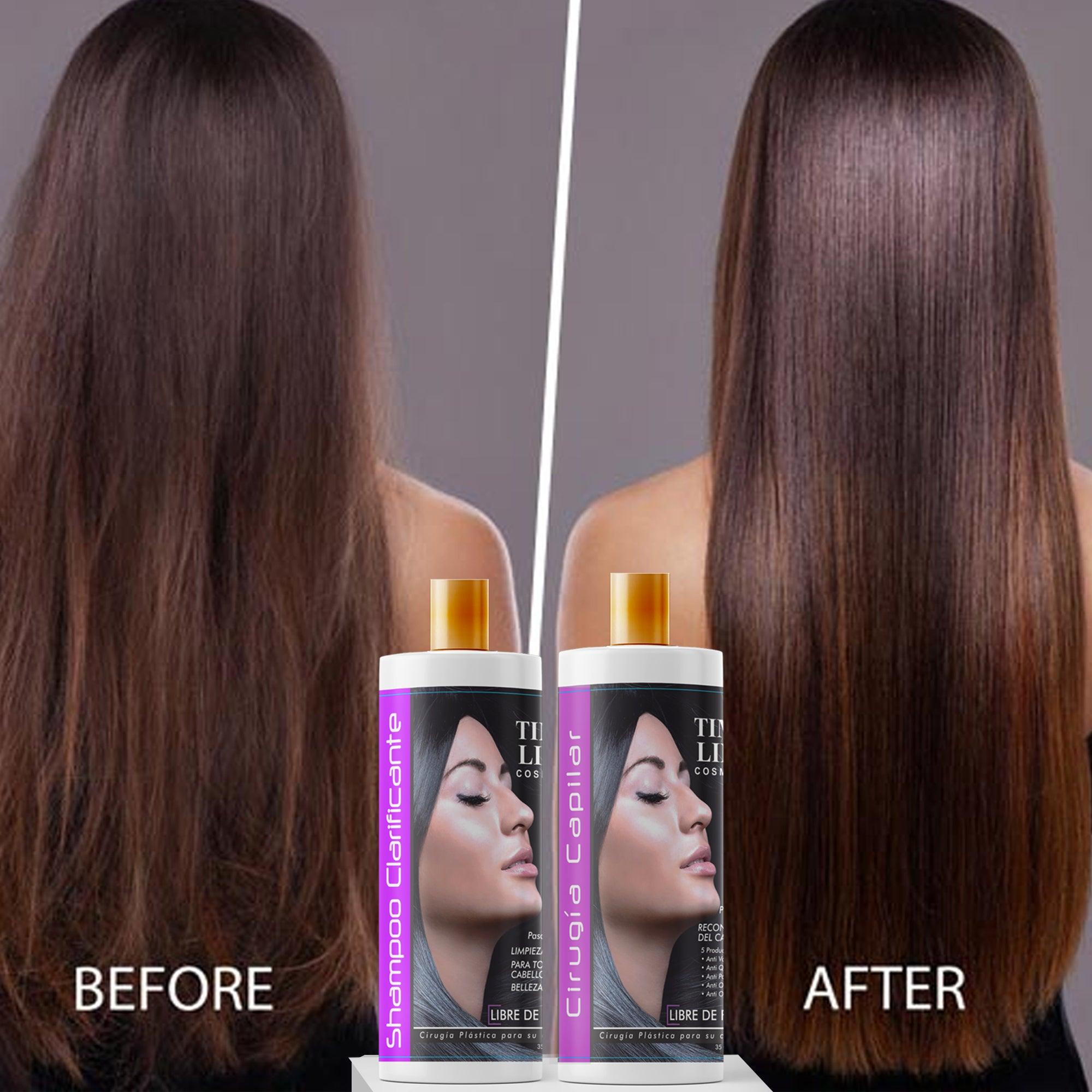 TIME LINE Professional Hair Surgery Treatment Kit, 5 Steps . 1- Hair Surgery For Professional Hair Keratin For Damaged Hair (4 Ounce) 2- Shampoo 4 oz 3- Leaven in 4. Spray Heat Protector 120 ml 5. Shine Drops 60 ml - AMOSTIMELINE